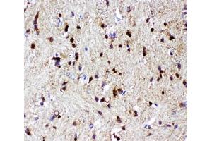 Immunohistochemistry (IHC) image for anti-Tumor Protein P73 (TP73) (AA 1-198) antibody (ABIN3029401)