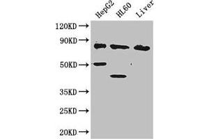 Western Blot Positive WB detected in: HepG2 whole cell lysate, HL60 whole cell lysate, Mouse liver tissue All lanes: PFKL antibody at 2. (PFKL Antikörper  (AA 229-479))