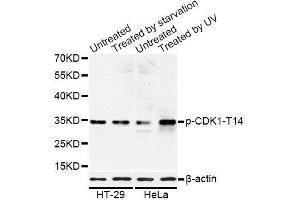 Western blot analysis of extracts of HT-29 and HeLa cells, using Phospho-CDK1-T14 antibody. (CDK1 Antikörper  (pThr14))