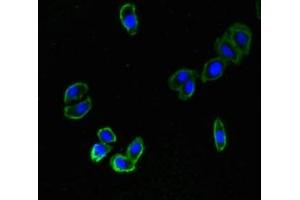 ZNRF3 Antikörper  (AA 56-219)