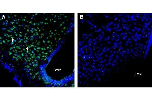 Expression of PTGFRN in mouse hypothalamus:Immunohistochemical staining of perfusion-fixed frozen mouse brain sections with Anti-PTGFRN (extracellular) Antibody (ABIN7581950), (1:300), followed by goat anti-rabbit-AlexaFluor-488.