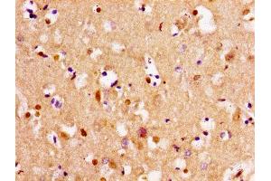 Immunohistochemistry of paraffin-embedded human brain tissue using ABIN7171992 at dilution of 1:100