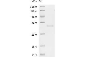 (Tris-Glycine gel) Discontinuous SDS-PAGE (reduced) with 5 % enrichment gel and 15 % separation gel.