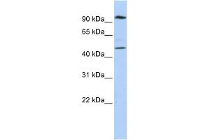 WB Suggested Anti-MARCH4 Antibody Titration:  0. (MARCH4 Antikörper  (N-Term))