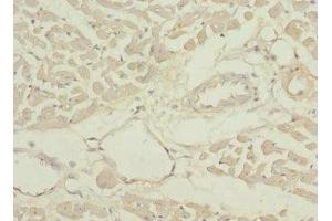 Immunohistochemistry of paraffin-embedded human heart tissue using ABIN7166902 at dilution of 1:100 (PDHB Antikörper  (AA 1-300))