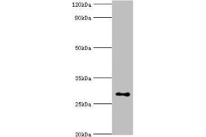 Western blot All lanes: Alpha-ketoglutarate-dependent dioxygenase alkB homolog 2 antibody at 2 μg/mL + Hela whole cell lysate Secondary Goat polyclonal to rabbit IgG at 1/10000 dilution Predicted band size: 30, 18 kDa Observed band size: 30 kDa (ALKBH2 Antikörper  (AA 1-261))