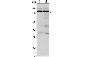 Western blot analysis using KDM3A mouse mAb against Hela (1) and HepG2 (2) cell lysate. (KDM3A Antikörper)