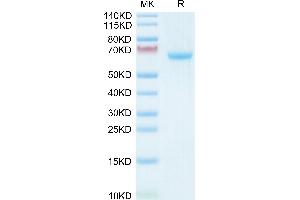 Human EFNA3 on Tris-Bis PAGE under reduced condition. (Ephrin A3 Protein (EFNA3) (AA 23-213) (Fc Tag))