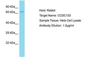 CCDC120 Antikörper  (AA 329-378)