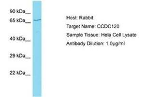 Image no. 1 for anti-Coiled-Coil Domain Containing 120 (CCDC120) (AA 329-378) antibody (ABIN6750717) (CCDC120 Antikörper  (AA 329-378))