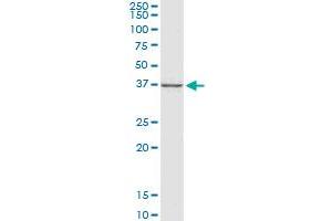 CTGF monoclonal antibody (M01), clone 2C11. (CTGF Antikörper  (AA 31-251))