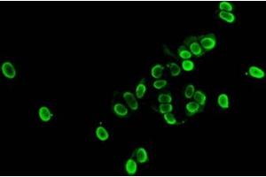 Immunofluorescent analysis of MCF-7 cells (sodium butyrate, 30 mM, 4h) using ABIN7139177 at dilution of 1:100 and Alexa Fluor 488-congugated AffiniPure Goat Anti-Rabbit IgG(H+L) (HIST1H1E Antikörper  (acLys33))
