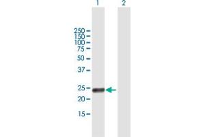 Western Blot analysis of RAET1G expression in transfected 293T cell line by RAET1G MaxPab polyclonal antibody. (Retinoic Acid Early Transcript 1G (RAET1G) (AA 1-213) Antikörper)