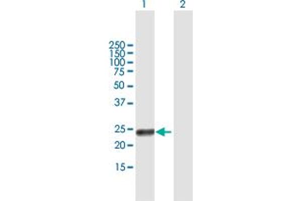 Retinoic Acid Early Transcript 1G (RAET1G) (AA 1-213) Antikörper