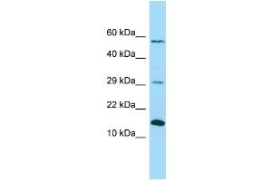 Western Blotting (WB) image for anti-NADH Dehydrogenase (Ubiquinone) 1 beta Subcomplex, 4, 15kDa (NDUFB4) (C-Term) antibody (ABIN2790563)