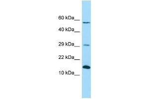 WB Suggested Anti-NDUFB4 Antibody Titration: 1. (NDUFB4 Antikörper  (C-Term))