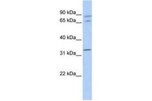 Image no. 1 for anti-Gap Junction Protein, alpha 4, 37kDa (GJA4) (AA 108-157) antibody (ABIN6740499) (GJA4 Antikörper  (AA 108-157))