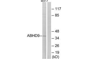 Western Blotting (WB) image for anti-Epoxide Hydrolase 3 (EPHX3) (Internal Region) antibody (ABIN1850667) (ABHD9 Antikörper  (Internal Region))