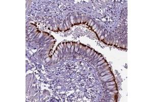 Immunohistochemical staining of human bronchus with CD99L2 polyclonal antibody  shows strong membranous positivity in respiratory epithelial cells.