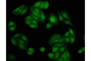 Immunofluorescence staining of HepG2 cells with ABIN7143530 at 1:200, counter-stained with DAPI. (NUDT5 Antikörper  (AA 34-166))