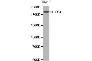 Western blot analysis of extracts of MCF7 cells lines, using ITGB4 antibody. (Integrin beta 4 Antikörper  (AA 28-310))