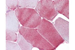 Immunohistochemistry (IHC) image for anti-Fatty Acid Binding Protein 3, Muscle and Heart (FABP3) (AA 72-121) antibody (ABIN6748608)