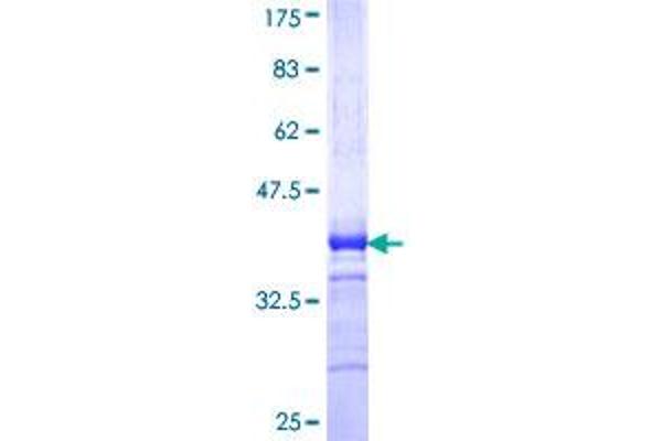 DDX3Y Protein (AA 1-80) (GST tag)