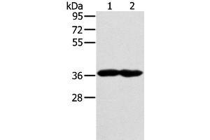 Western Blot analysis of Mouse heart and muscle tissue using GNAT3 Polyclonal Antibody at dilution of 1:400 (GNAT3 Antikörper)