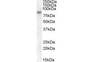 ABIN263199 (1µg/ml) staining of Human Pancreas lysate (35µg protein in RIPA buffer).