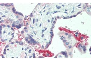 Detection of ECM1 in Human Placenta Tissue using Polyclonal Antibody to Extracellular Matrix Protein 1 (ECM1)