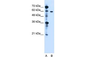 WB Suggested Anti-ZDHHC13 Antibody Titration:  1. (ZDHHC13 Antikörper  (N-Term))
