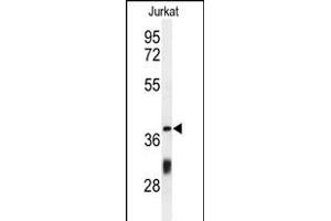 Western blot analysis of C Antibody (Center) (ABIN650934 and ABIN2840000) in Jurkat cell line lysates (35 μg/lane). (CCDC130 Antikörper  (AA 173-200))