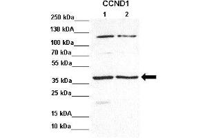 Lanes : Lane 1: 30ug PKO lysateLane 2: 30ug PKO + Doxor lysate  Primary Antibody Dilution :  1:1000   Secondary Antibody : Goat anti rabbit-HRP  Secondary Antibody Dilution :  1:5000  Gene Name : CCND1  Submitted by : Tobias Wagner, Institute for Biochemistry and Biophysics (Cyclin D1 Antikörper  (Middle Region))