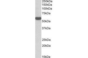 Western Blotting (WB) image for anti-Chromosome 22 Open Reading Frame 28 (C22orf28) (Internal Region) antibody (ABIN2464466) (C22orf28 Antikörper  (Internal Region))