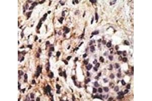 Immunohistochemistry (IHC) image for anti-Beclin 1, Autophagy Related (BECN1) (AA 210-239) antibody (ABIN3030156)