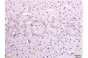 Formalin-fixed and paraffin embedded rat brain labeled with Anti-Caspase-9 Polyclonal Antibody, Unconjugated (ABIN724175) 1:300 followed by conjugation to the secondary antibody and DAB staining