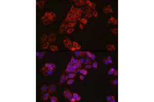 Immunofluorescence analysis of HepG2 cells using Niemann Pick C1 antibody (ABIN7268911) at dilution of 1:50.