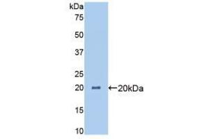 Western blot analysis of recombinant Pig ANGPTL4. (ANGPTL4 Antikörper  (AA 227-389))