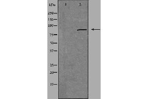 Western blot analysis of extracts from HUVEC cells, using CGK 2 antibody. (PRKG2 Antikörper  (N-Term))