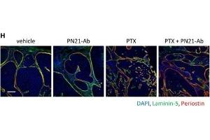 Immunofluorescence (Paraffin-embedded Sections) (IF (p)) image for anti-Periostin (POSTN) (C-Term) antibody (ABIN2854805)