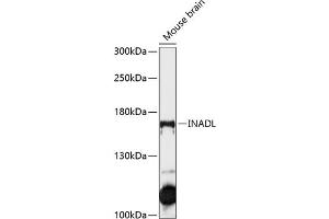 Western blot analysis of extracts of mouse brain, using INADL antibody (ABIN6134720, ABIN6142437, ABIN6142439 and ABIN6215633) at 1:1000 dilution. (PATJ Antikörper  (AA 1-100))