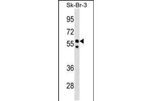 Western blot analysis in SK-BR-3 cell line lysates (35ug/lane). (FBXO31 Antikörper  (AA 310-338))