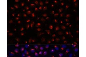Immunofluorescence analysis of HeLa cells using ACTN3 Polyclonal Antibody at dilution of 1:100 (40x lens). (ACTN3 Antikörper)