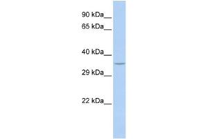 WB Suggested Anti-SPDYA Antibody Titration: 0. (SPDYA Antikörper  (N-Term))