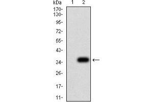 Western Blotting (WB) image for anti-Purinergic Receptor P2Y, G-Protein Coupled, 8 (P2RY8) antibody (ABIN5611348)