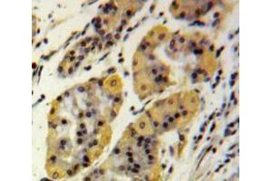 IHC-P analysis of Stomach tissue, with DAB staining. (MMP2 Antikörper  (AA 110-660))