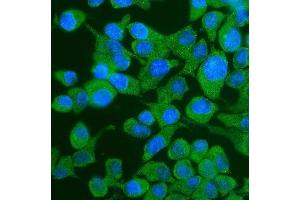 IF analysis of YTHDF2 using anti-YTHDF2 antibody (ABIN7603191). (YTHDF2 Antikörper  (N-Term))