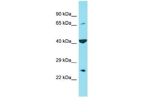 Host: Rabbit Target Name: C6orf120 Sample Type: Hela Whole cell lysates Antibody Dilution: 1. (C6ORF120 Antikörper  (C-Term))