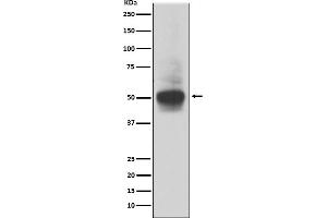 Western blot analysis of RUNX1/RUNX2/RUNX3 expression in MOLT4 cell lysate. (Rekombinanter RUNX1,RUNX2,RUNX3 Antikörper)