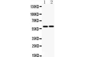 Anti-LTBR antibody, Western blotting All lanes: Anti LTBR  at 0.